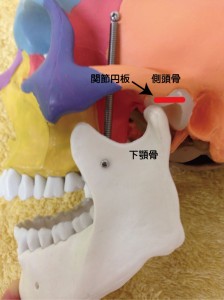 顎関節症の説明